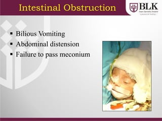 Intestinal Obstruction
 Bilious Vomiting
 Abdominal distension
 Failure to pass meconium
 