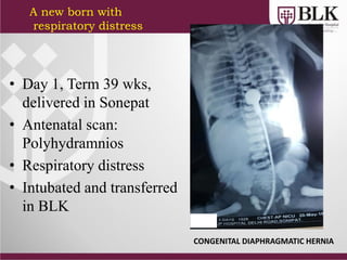 • Day 1, Term 39 wks,
delivered in Sonepat
• Antenatal scan:
Polyhydramnios
• Respiratory distress
• Intubated and transferred
in BLK
A new born with
respiratory distress
CONGENITAL DIAPHRAGMATIC HERNIA
 