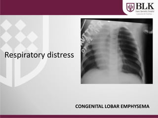 Respiratory distress
CONGENITAL LOBAR EMPHYSEMA
 