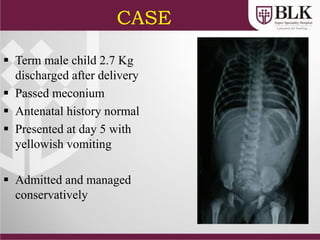 CASE
 Term male child 2.7 Kg
discharged after delivery
 Passed meconium
 Antenatal history normal
 Presented at day 5 with
yellowish vomiting
 Admitted and managed
conservatively
 