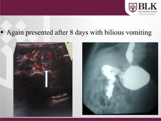  Again presented after 8 days with bilious vomiting
 