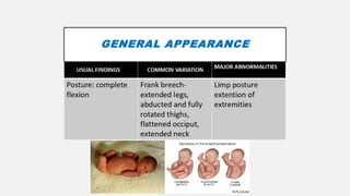 Newborn, both normal and abnormal neonatology, including high risk new ...