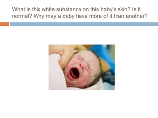 What is this white substance on this baby’s skin? Is it normal? Why may a baby have more of it than another?