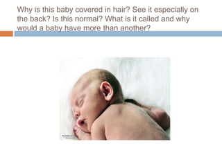 Why is this baby covered in hair? See it especially on the back? Is this normal? What is it called and why would a baby have more than another?