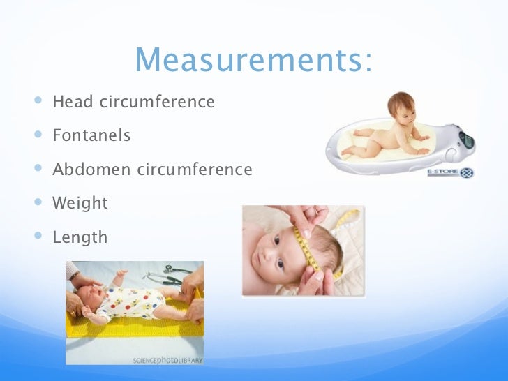 Newborn Assessment newborn-assessment