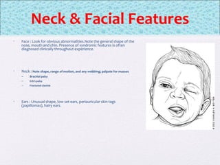 Neck & Facial Features
• Face : Look for obvious abnormalities.Note the general shape of the
nose, mouth and chin. Presence of syndromic features is often
diagnosed clinically throughout experience.
• Neck : Note shape, range of motion, and any webbing; palpate for masses
– Brachial palsy
– Erb’s palsy
– Fractured clavicle
• Ears : Unusual shape, low set ears, periauricular skin tags
(papillomas), hairy ears.
 