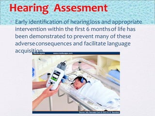 Hearing Assesment
• Early identification of hearingloss and appropriate
intervention within the first 6 monthsof life has
been demonstrated to prevent many of these
adverseconsequences and facilitate language
acquisition.
 