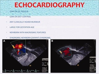 ECHOCARDIOGRAPHY
• GDM ON S/C INSULIN
• GDM ON DIET CONTROL
• ANY CLINICALLY HEARD MURMUR
• LARGE FOR GESTATION AGE
• NEWBORN WITH MACROSMIC FEATURES
• SYNDROMIC NEWBORN (DOWN’S SYNDROME,
 