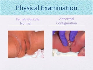 Physical Examination
Normal
Abnormal
Configuration
Female Genitalia
 