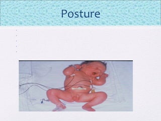 Posture
•
•
•
•
•
 