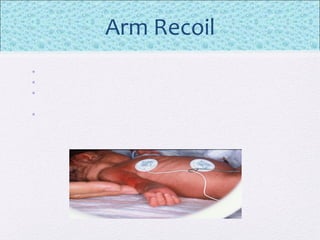Arm Recoil
•
•
•
•
 