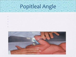 Popitleal Angle
•
•
•
•
•
 