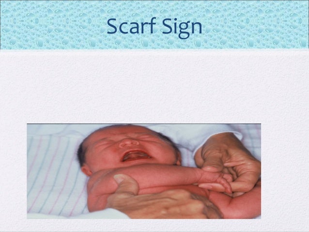 Newborn Assessment newborn-assessment
