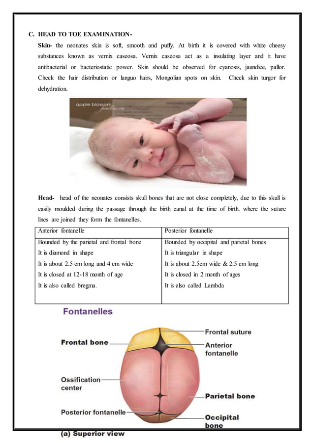 Newborn assessment