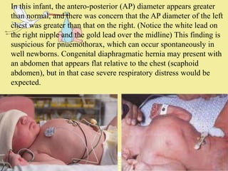 Newborn assessment | PPT