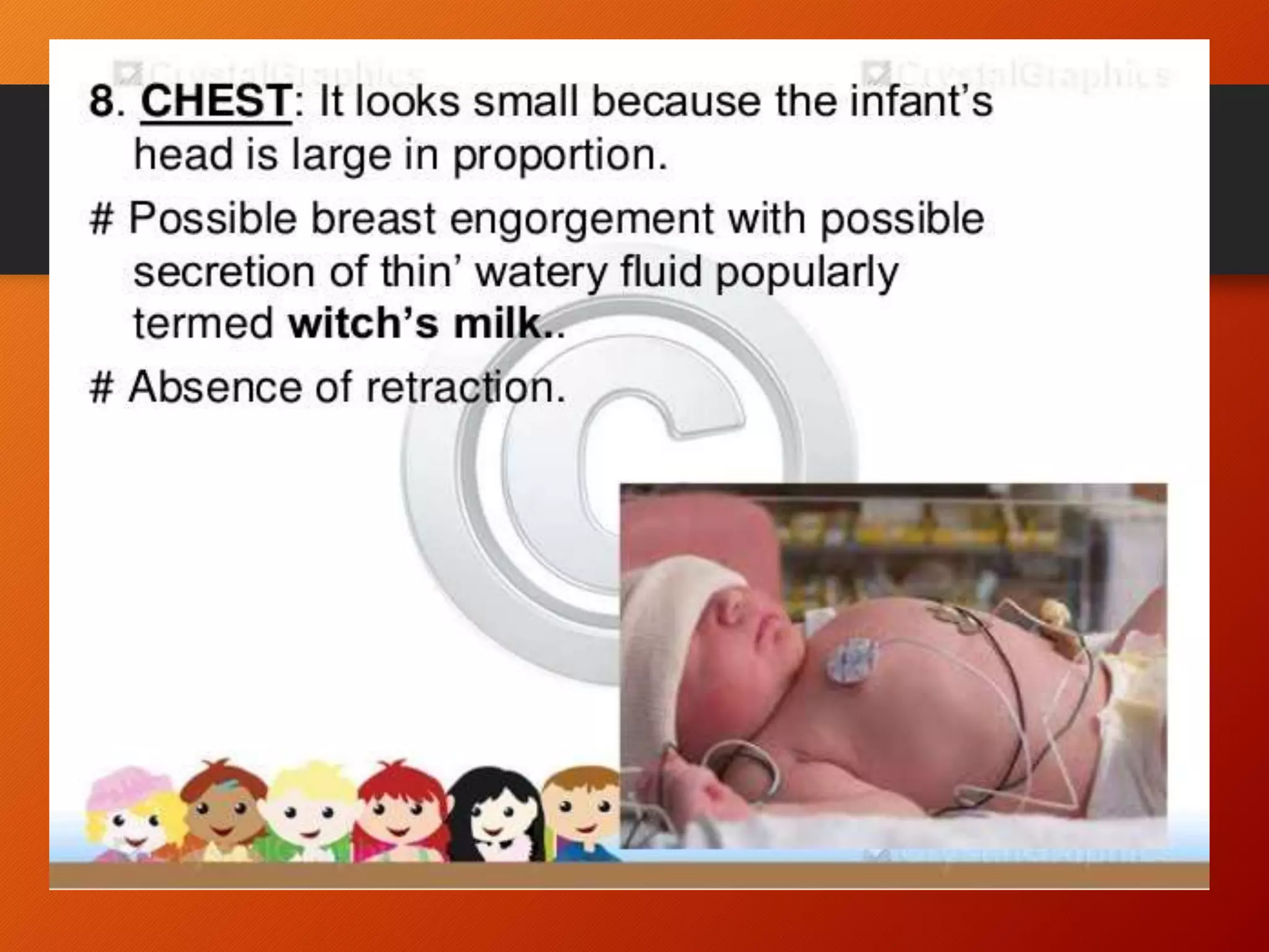 Newborn Assessment Ppt