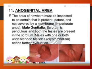 NEWBORN ASSESSMENT