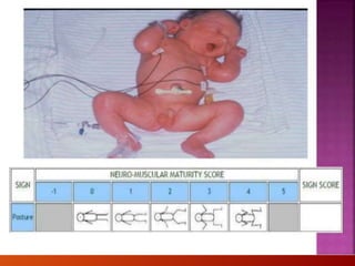 NEWBORN ASSESSMENT
