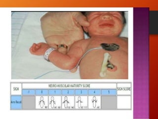 NEWBORN ASSESSMENT