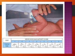 NEWBORN ASSESSMENT