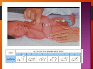 NEWBORN ASSESSMENT