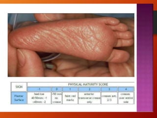 NEWBORN ASSESSMENT
