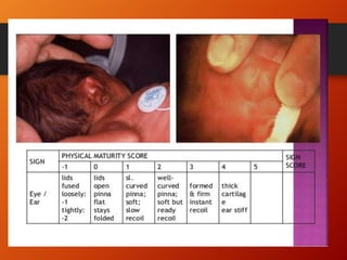 NEWBORN ASSESSMENT