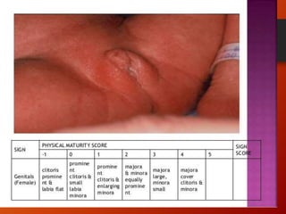 NEWBORN ASSESSMENT