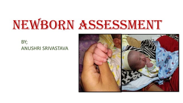 Newborn Assessment Pdf Newborn Assessment Pdf