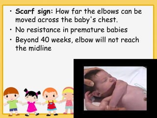 Carf Sign neonatal assessment ppt - shani jyothis | PPT