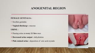 Comprehensive Newborn Assessment: Physical and Behavioral Evaluation in ...