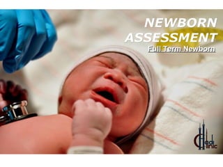 NEWBORNNEWBORN
ASSESSMENTASSESSMENT
Full Term NewbornFull Term Newborn
 