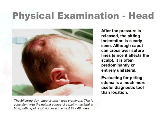 Why Is A Neonate’s Head More “moldable”? Newborn Assessment by Hadi Hospital NICU.