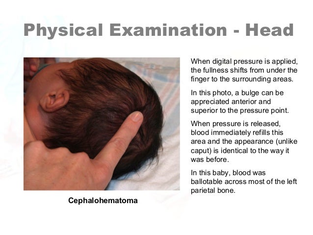 Why Is A Neonate’s Head More “moldable”? Newborn Assessment by Hadi Hospital NICU.