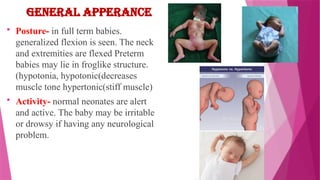 Hypertonic Rigid Posture new born assessment of child health nursing | PPTX