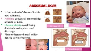 new born assessment of child health nursing | PPTX