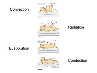 Convection
Radiation
Evaporation
Conduction
 