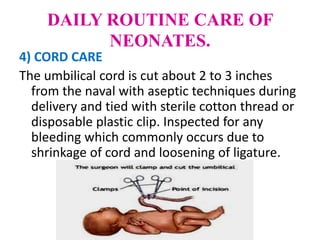 DAILY ROUTINE CARE OF
NEONATES.
4) CORD CARE
The umbilical cord is cut about 2 to 3 inches
from the naval with aseptic techniques during
delivery and tied with sterile cotton thread or
disposable plastic clip. Inspected for any
bleeding which commonly occurs due to
shrinkage of cord and loosening of ligature.
 