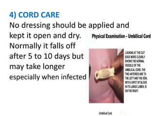 4) CORD CARE
No dressing should be applied and
kept it open and dry.
Normally it falls off
after 5 to 10 days but
may take longer
especially when infected.
 