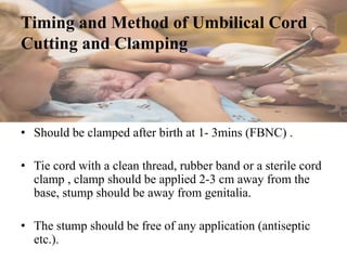 Timing and Method of Umbilical Cord
Cutting and Clamping
• Should be clamped after birth at 1- 3mins (FBNC) .
• Tie cord with a clean thread, rubber band or a sterile cord
clamp , clamp should be applied 2-3 cm away from the
base, stump should be away from genitalia.
• The stump should be free of any application (antiseptic
etc.).
 