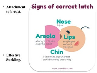 • Attachment
to breast.
• Effective
Suckling.
 
