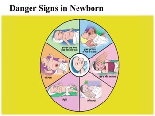 Danger Signs in Newborn
 
