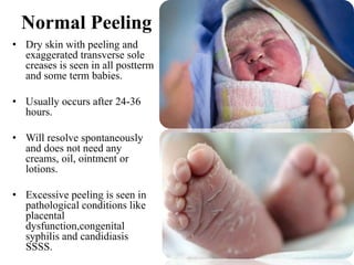 Normal Peeling
• Dry skin with peeling and
exaggerated transverse sole
creases is seen in all postterm
and some term babies.
• Usually occurs after 24-36
hours.
• Will resolve spontaneously
and does not need any
creams, oil, ointment or
lotions.
• Excessive peeling is seen in
pathological conditions like
placental
dysfunction,congenital
syphilis and candidiasis
SSSS.
 