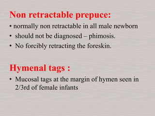 Non retractable prepuce:
• normally non retractable in all male newborn
• should not be diagnosed – phimosis.
• No forcibly retracting the foreskin.
Hymenal tags :
• Mucosal tags at the margin of hymen seen in
2/3rd of female infants
 
