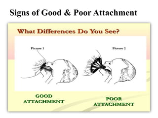 Signs of Good & Poor Attachment
 