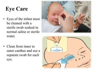 Eye Care
• Eyes of the infant must
be cleaned with a
sterile swab soaked in
normal saline or sterile
water.
• Clean from inner to
outer canthus and use a
separate swab for each
eye.
 