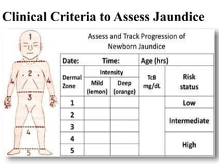 Clinical Criteria to Assess Jaundice
 