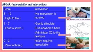 Essential Newborn Care In Clinical Settings | PPTX