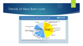Trends of New Born care
30
 
