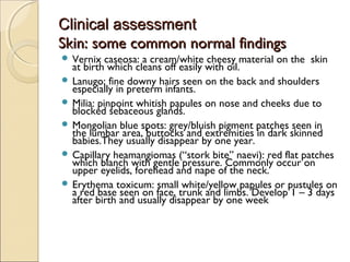 Clinical assessment
Skin: some common normal findings
 Vernix

caseosa: a cream/white cheesy material on the skin
at birth which cleans off easily with oil.
 Lanugo; fine downy hairs seen on the back and shoulders
especially in preterm infants.
 Milia: pinpoint whitish papules on nose and cheeks due to
blocked sebaceous glands.
 Mongolian blue spots: grey/bluish pigment patches seen in
the lumbar area, buttocks and extremities in dark skinned
babies.They usually disappear by one year.
 Capillary heamangiomas (“stork bite” naevi): red flat patches
which blanch with gentle pressure. Commonly occur on
upper eyelids, forehead and nape of the neck.
 Erythema toxicum: small white/yellow papules or pustules on
a red base seen on face, trunk and limbs. Develop 1 – 3 days
after birth and usually disappear by one week

 